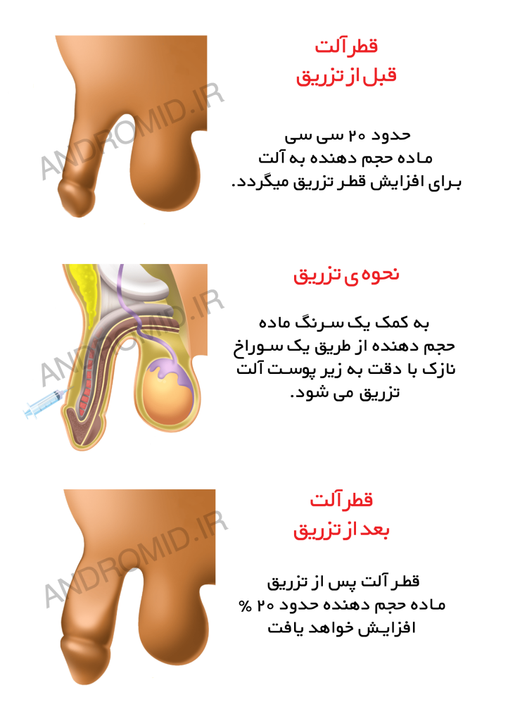 اندازه نرمال آلت تناسلی مرد و ارتباط آن با لذت جنسی